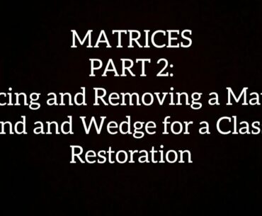 MATRICES, PART 2: Placing and Removing a Matrix Band and Wedge for a Class II Restoration