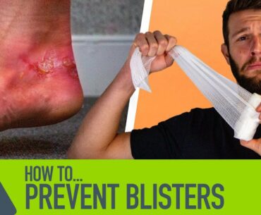 How To Prevent Blisters When Running | Stop Your Run Shoes Rubbing