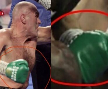 (BREAKING NEWS) TYSON FURY MAY NOW BE FACING BAN FROM SPORT AFTER NEW EVIDENCE SURFACES