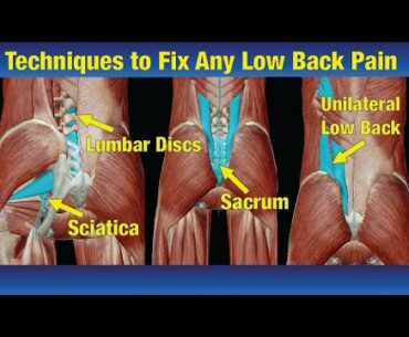 Techniques to Heal Any Low back Pain Instantly - Sciatica, Lumbar, & One Sided Pain