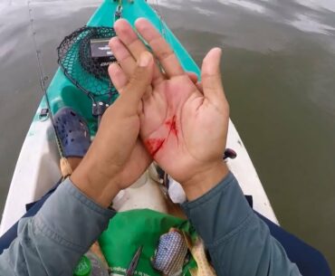 Got Seriously Injured by Catfish - GRAPHIC (Catfish fishing fail)