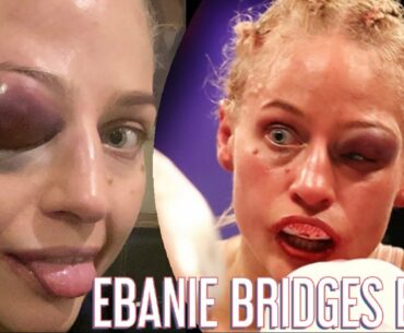 WARRIOR!!! EBANIE BRIDGES SHOWS EYE POST FIGHT! SHUT IN LAST TWO ROUNDS!