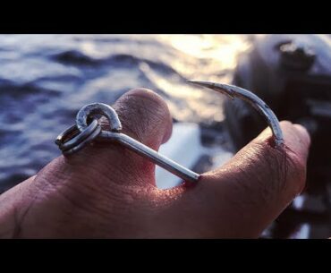 This Is Going To Hurt... How To Remove A Massive Fishing Hook.