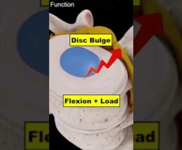 Back Rounding When Deadlifting