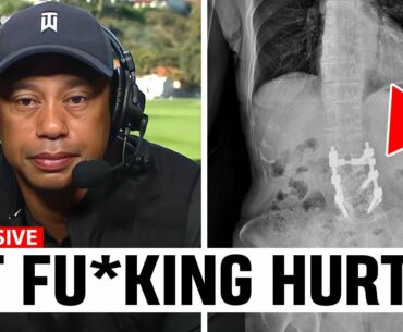 Tiger Woods Golf Future Is NOT Looking Good.. Here's Why