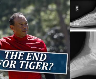 Could Surgery Spell End For Tiger Woods's Golf Career?