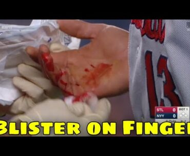 MLB | Unexpected Injuries 2