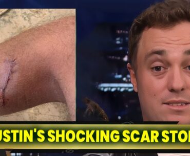 Justin Thomas Unmasks the Shocking Truth Behind His Scar