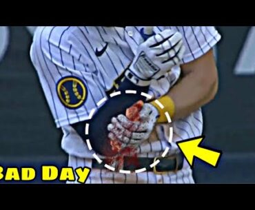 MLB | Bad Day (Hit By Pitch)